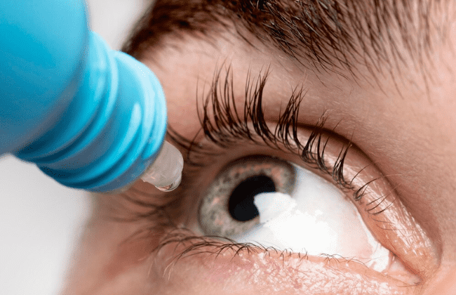 Infección ocular común